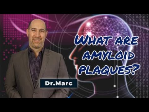Video: What are Amyloid Plaques?